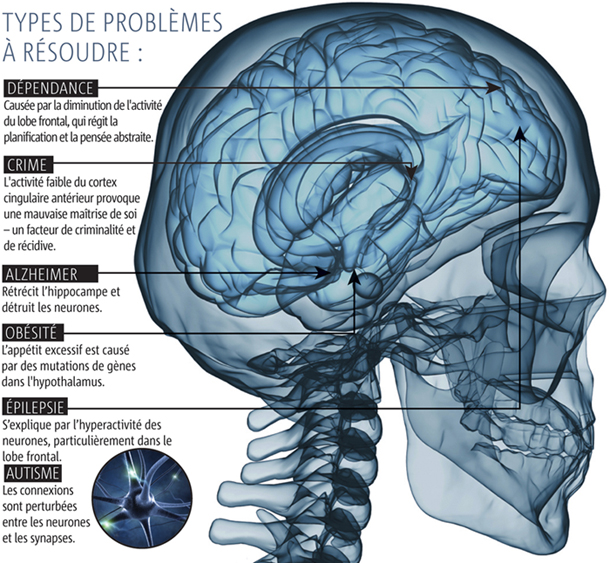 Cerveau