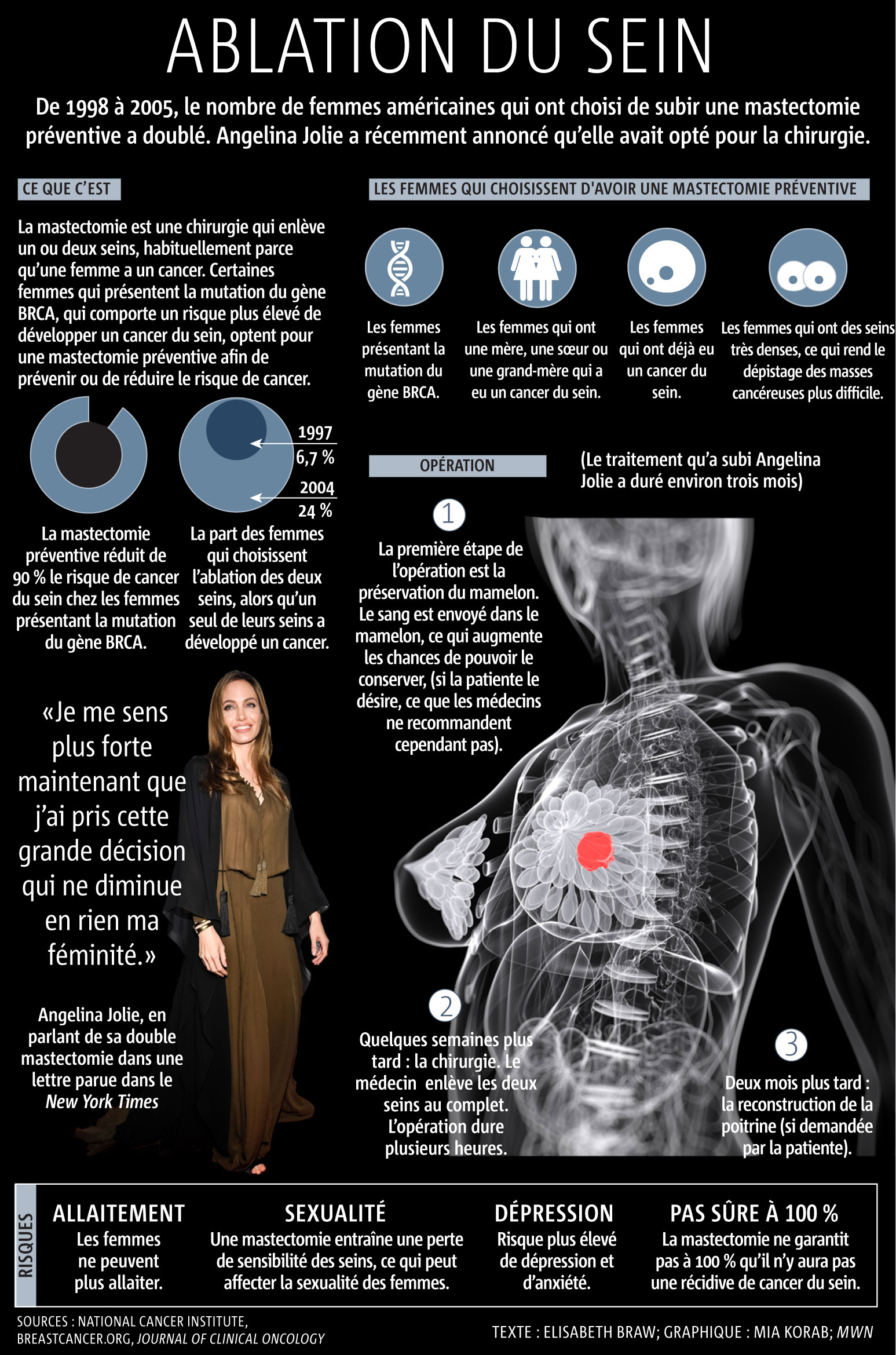 GRAPH_FR-MASTECTOMIE