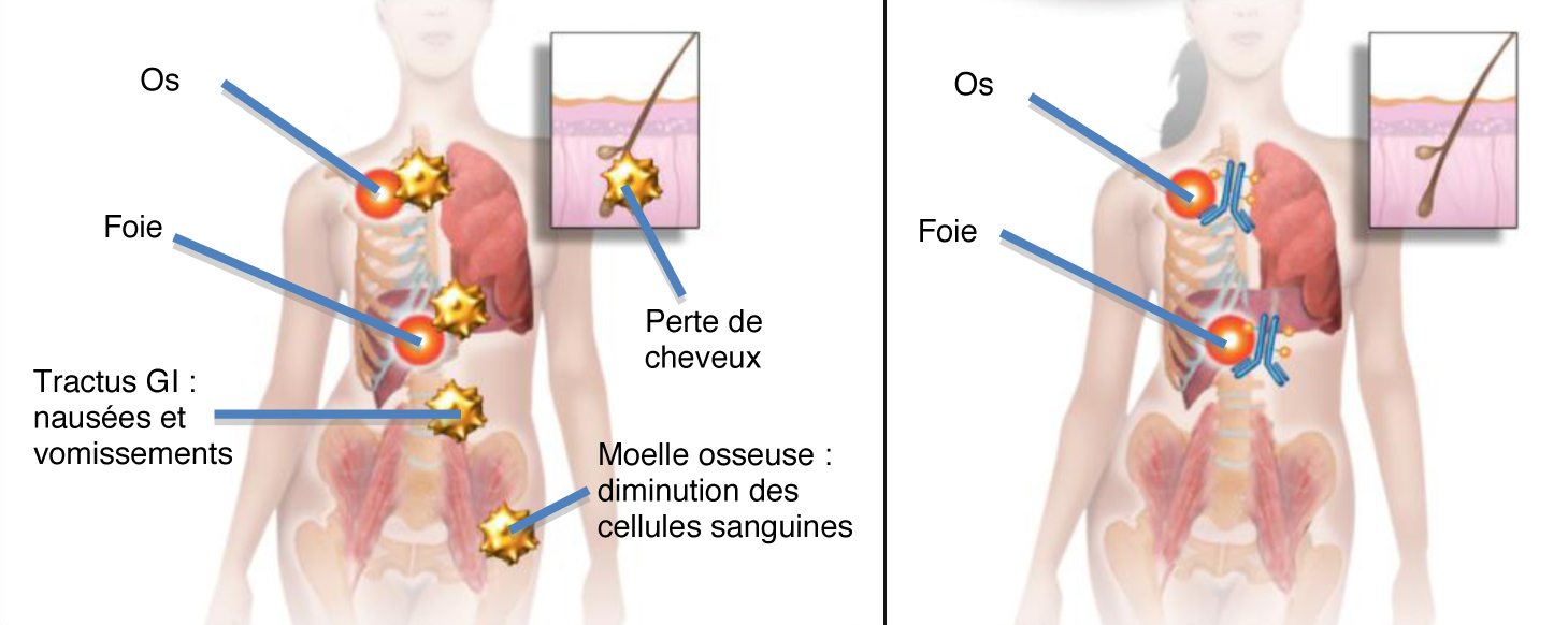 Graphique tumeurs