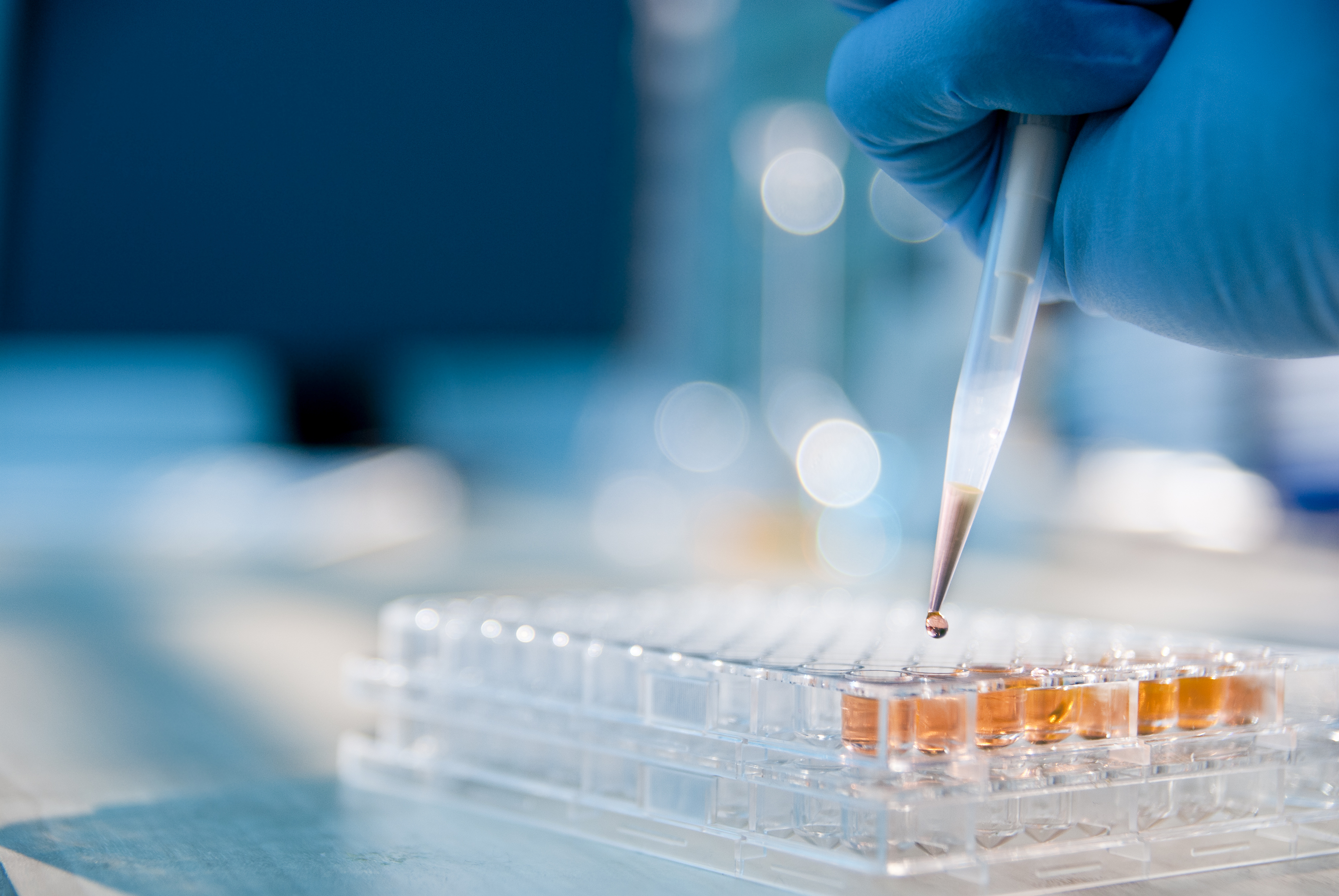 ACTU - test laboratoire