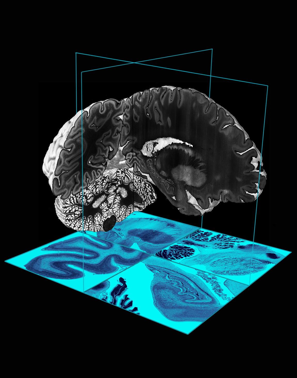 ACTU - Plate-forme numérique cerveau