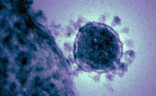 Coronavirus États-Unis