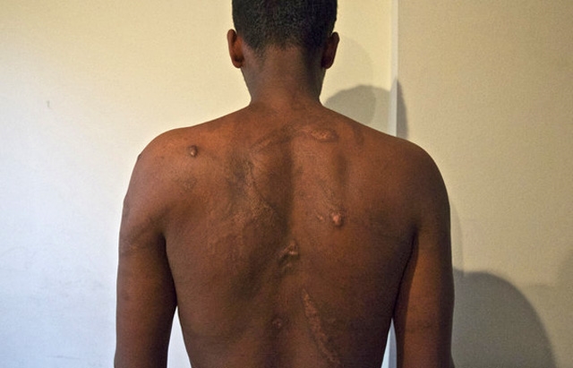 Témoin des exactions