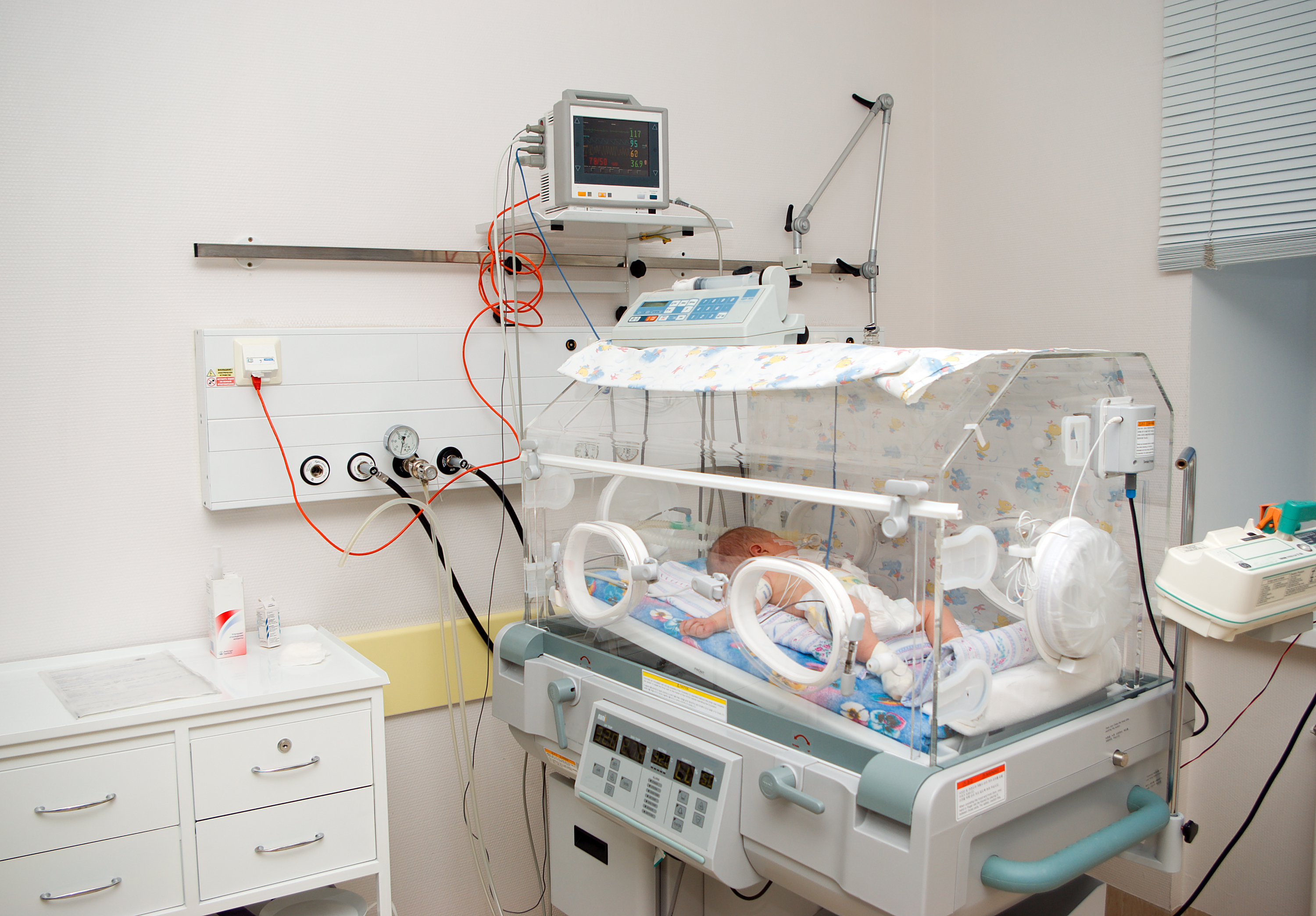 Детская реаниматология. Реанимационный кувейз для новорожденных. Асфиксия новорожденных кювез. Кювез для новорожденных в реанимации. Кювез для новорожденных недоношенных.