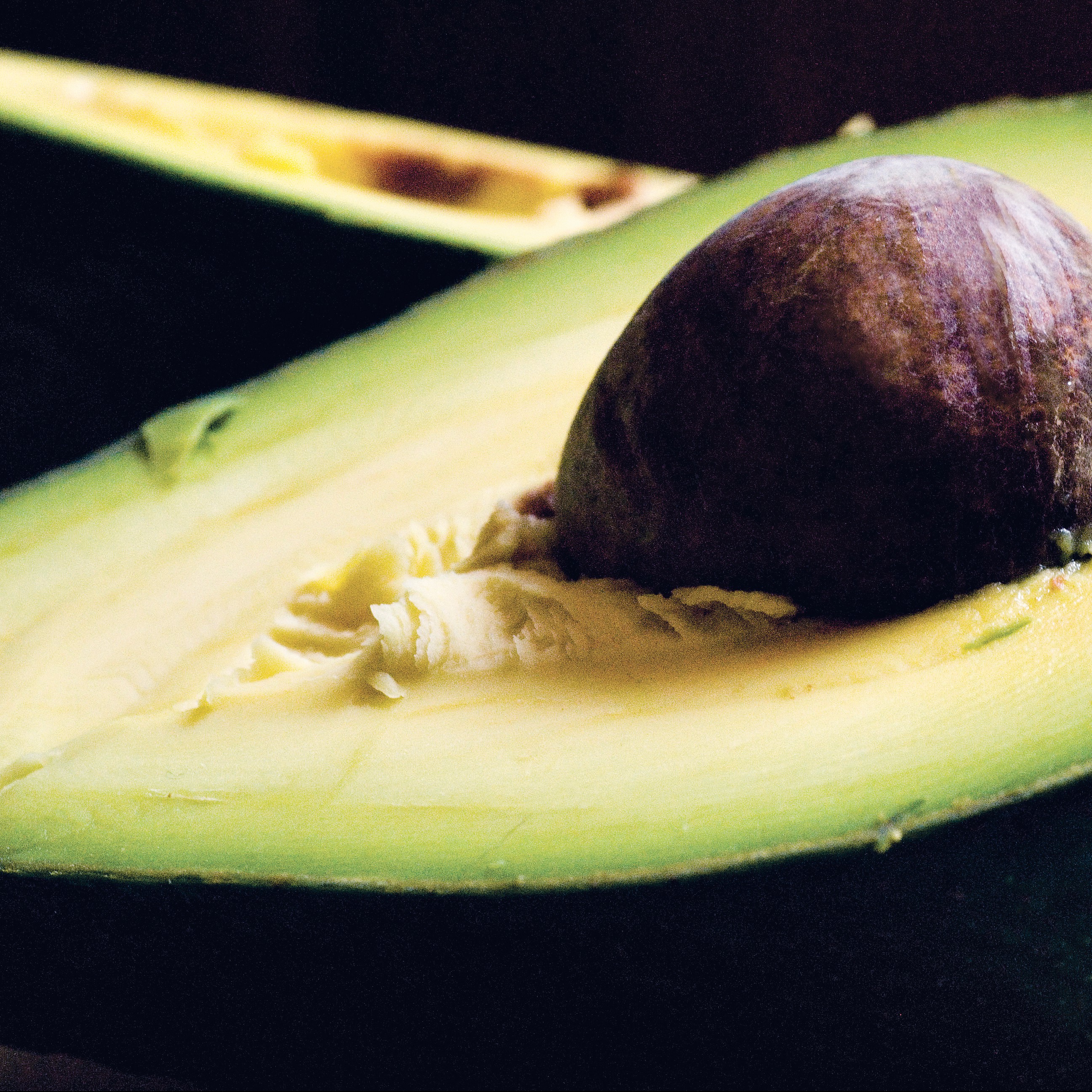 avocat
