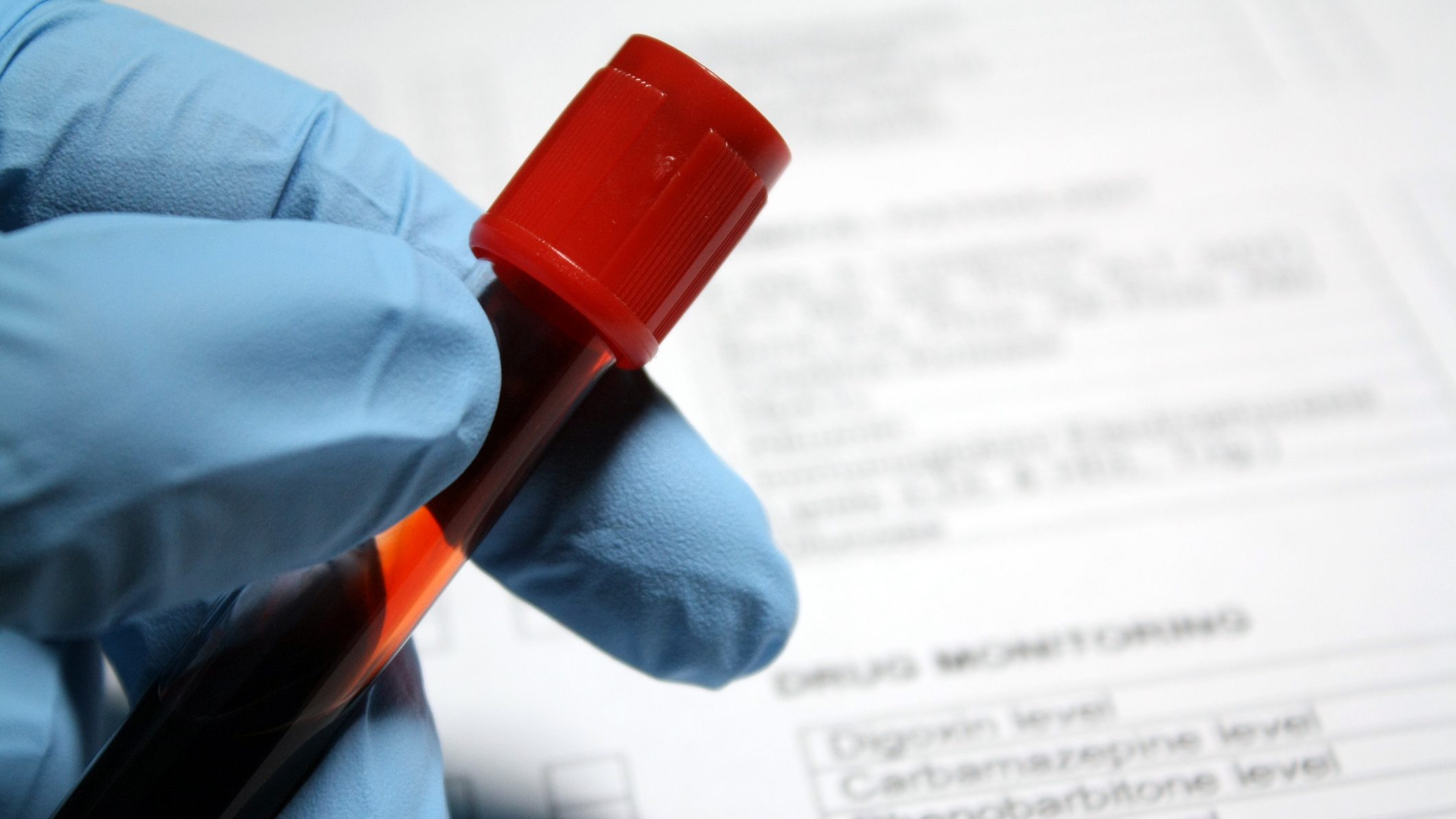 thérapies vih États Unis