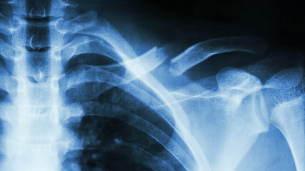 violences faites aux femmes