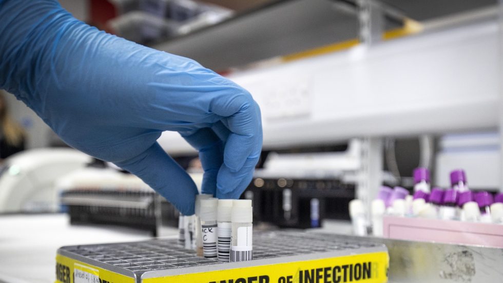 Les tests pour le coronavirus s'accélèrent à Montréal.