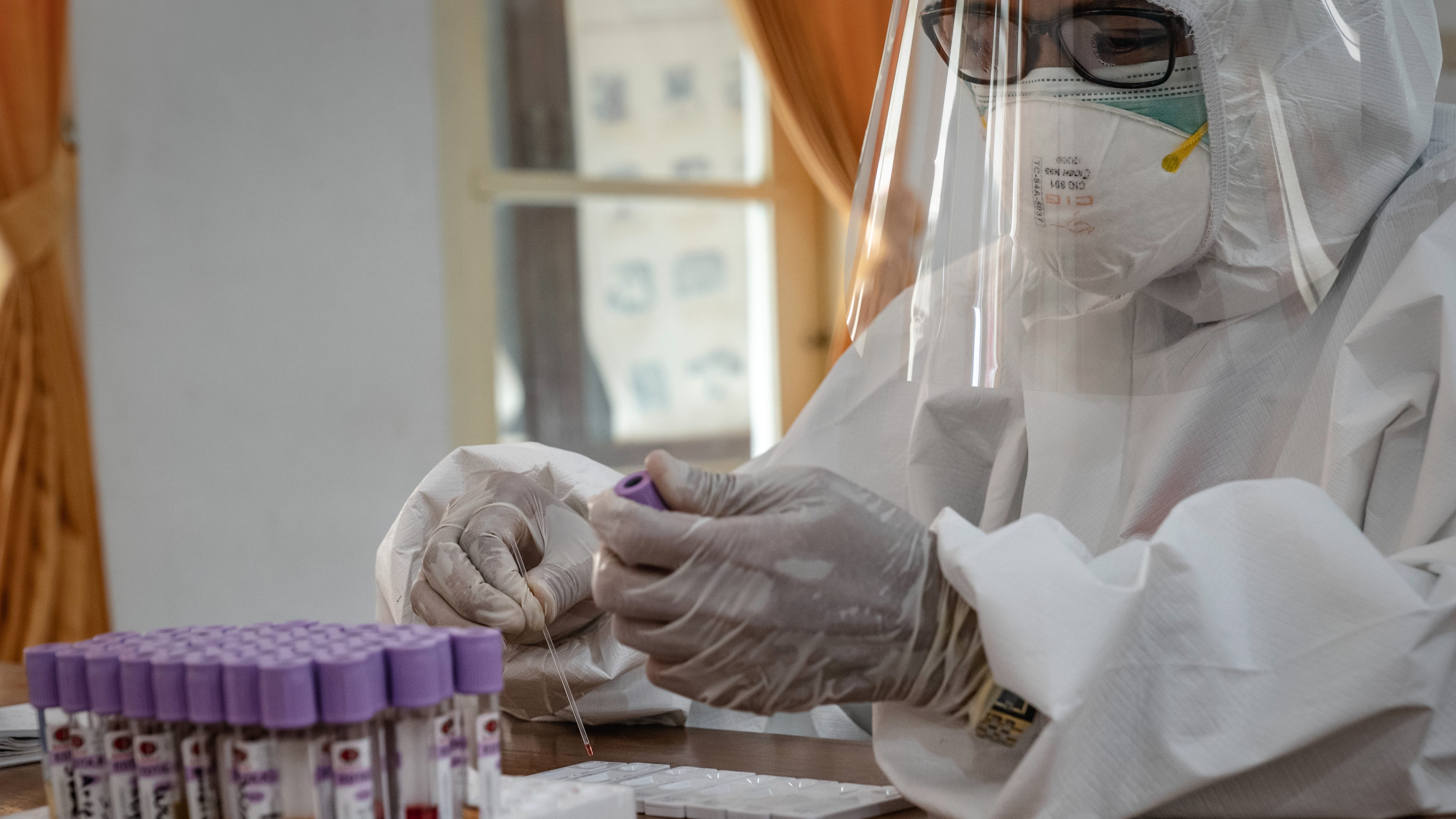 Coronavirus: près de 260 000 morts dans le monde