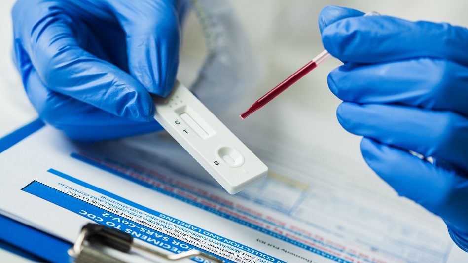La présence d’anticorps a été détectée grâce à des tests sanguins de prévalence.
