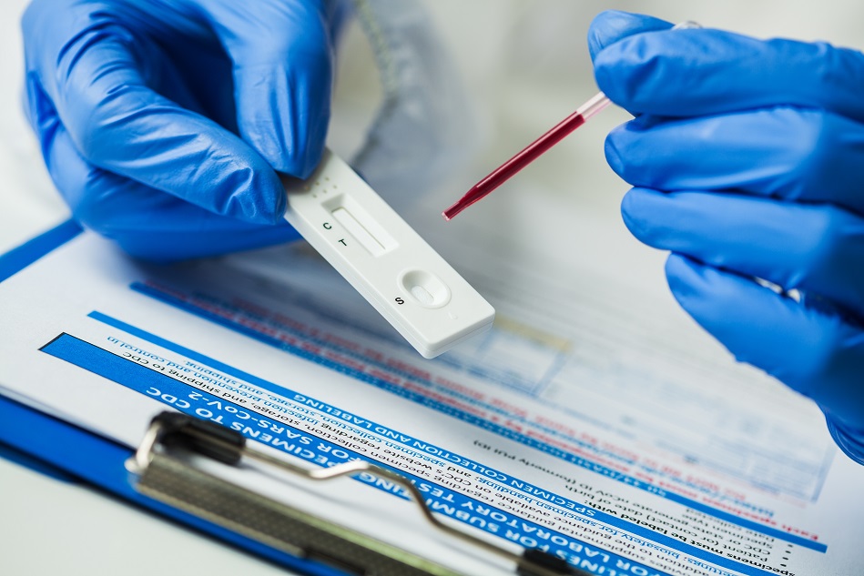 La présence d’anticorps a été détectée grâce à des tests sanguins de prévalence.